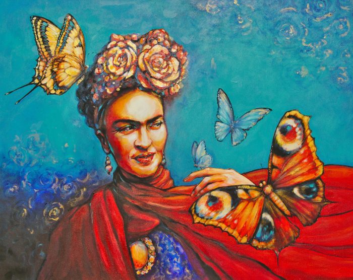 Síndrome Frida Kahlo