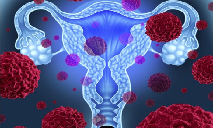»Ni una mujer debería morir por cáncer cervicouterino»: Nosotras Primero