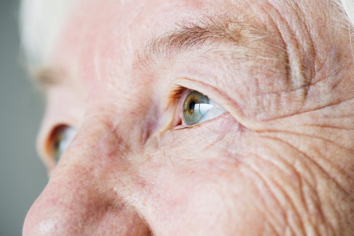 Cómo detectar el glaucoma para prevenir la ceguera