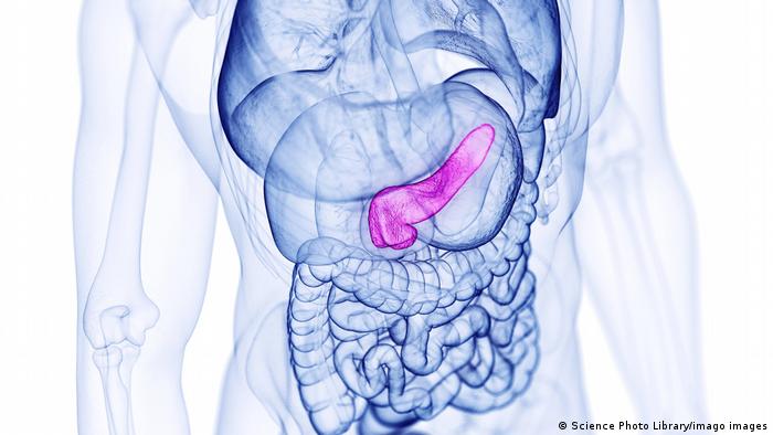 Cáncer de páncreas: ¿puede ayudar la vacuna de ARNm?