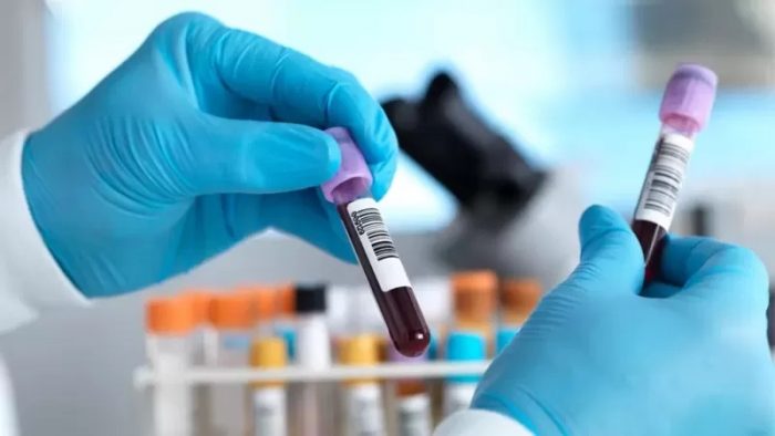El prometedor examen de sangre para detectar más de 50 tipos cáncer que entusiasma a los científicos