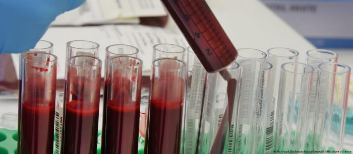 Nuevo análisis de sangre podría ayudar a detectar el cáncer