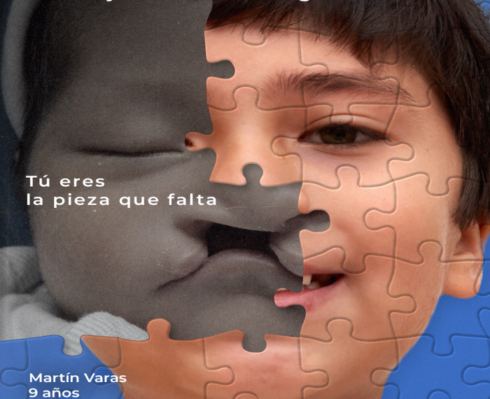Realizan colecta anual para devolver la sonrisa a niños y niñas con fisura labio palatina