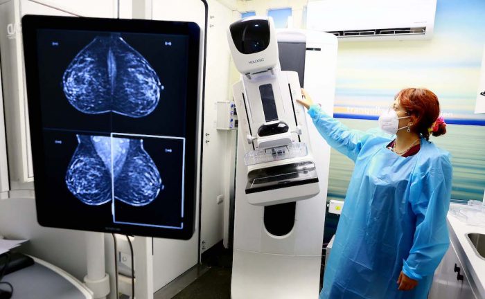 Cáncer de mama: la importancia de prevenir y de detectar la enfermedad a tiempo