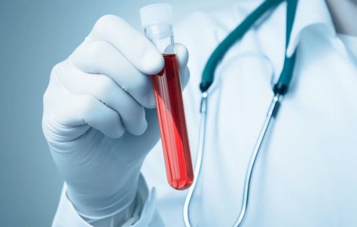 ¿Es realmente necesario ayunar para un análisis de sangre?