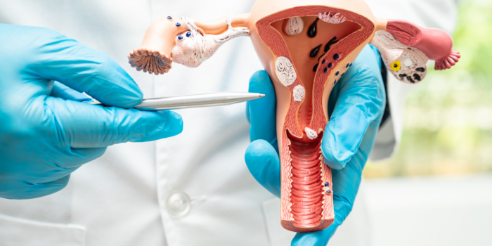 Implementan plan de autotoma de Virus del Papiloma Humano para prevenir cáncer cervicouterino