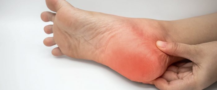 La neuropatía, una enfermedad que afecta a más del 50% de personas con diabetes