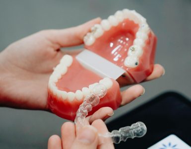 Hasta la pérdida de dientes: Peligros asociados a estafas por tratamientos de ortodoncia invisible