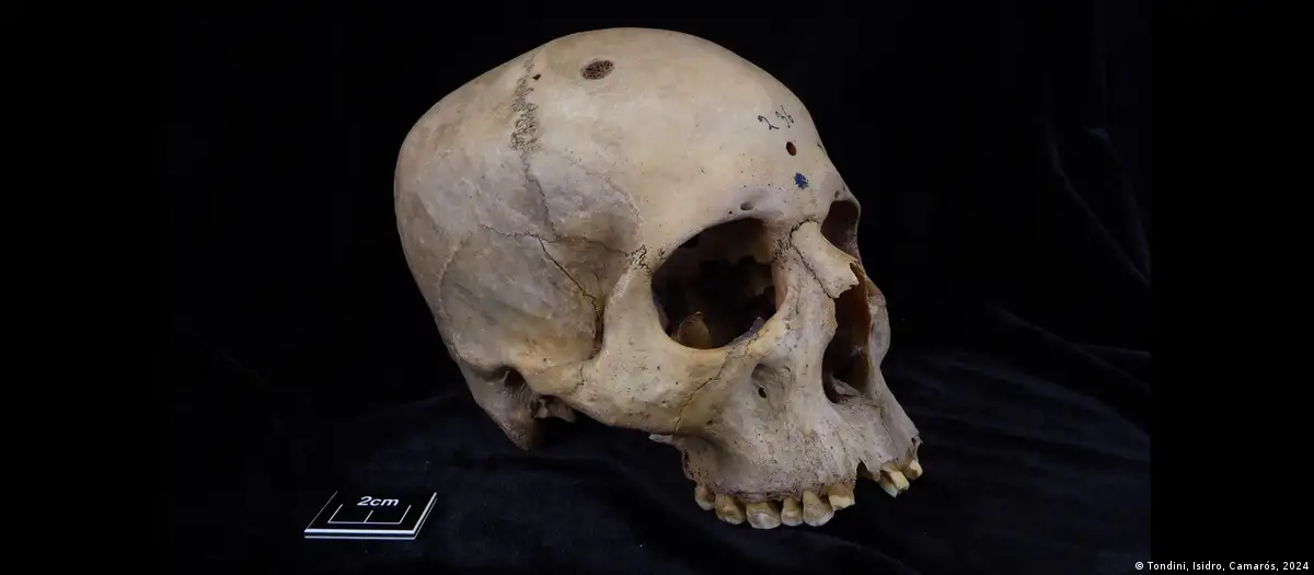 Antiguos egipcios practicaron cirugía oncológica