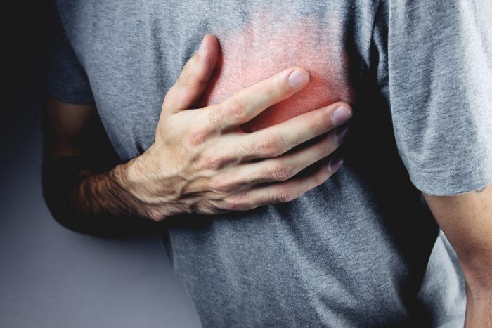 El 10% de los infartos ocurren a menores de 40 años: la necesidad de tomar medidas preventivas