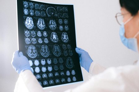 Mujeres jóvenes se transforman en uno de los principales grupos de riesgo de ataque cerebrovascular