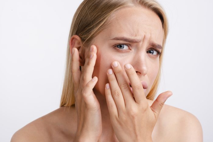9 causas desconocidas de la piel seca: menopausia, estrés y la genética pueden ser algunos factores