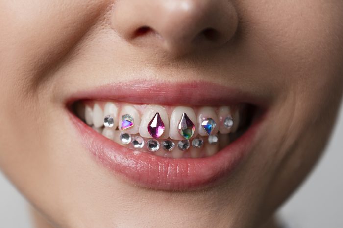 Por qué los grillz dentales son una moda peligrosa: conoce los riesgos para tu salud oral