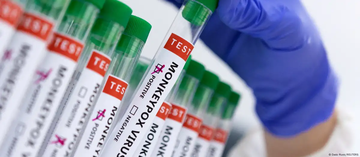 ¿Qué es el mpox, cómo se contagia y cómo se puede prevenir?