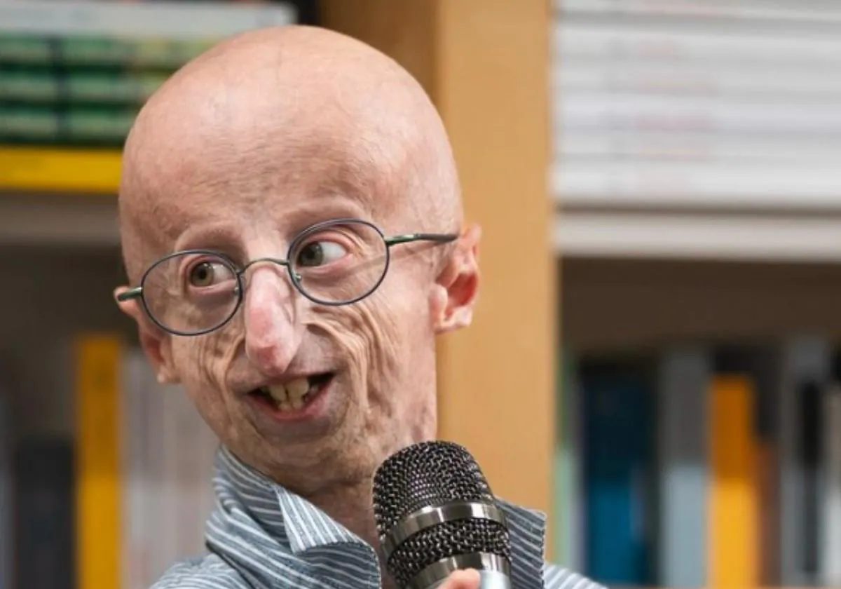 Qué es la progeria: la rara enfermedad que envejeció prematuramente a Sammy Basso