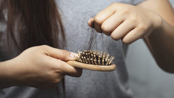 Alopecia femenina: 1 de cada 4 mujeres se verá afectada en algún momento de su vida