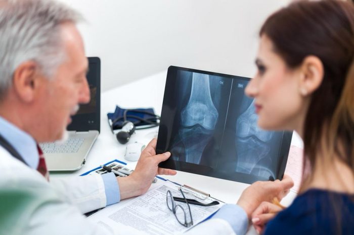 Osteoporosis: mitos, verdades y cómo detectar esta silenciosa enfermedad antes de una fractura