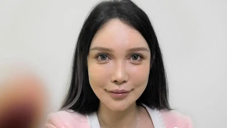“Me he sometido a más de 100 operaciones y no pararé”: el boom de la cirugía estética en China