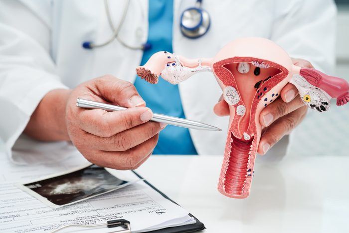 ¿Qué debemos saber sobre el cáncer de ovario?