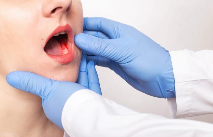 Cáncer de mandíbula: síntomas, factores de riesgo y cómo detectarlo a tiempo según expertos
