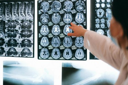 Tres claves para la salud de tu cerebro según la ciencia