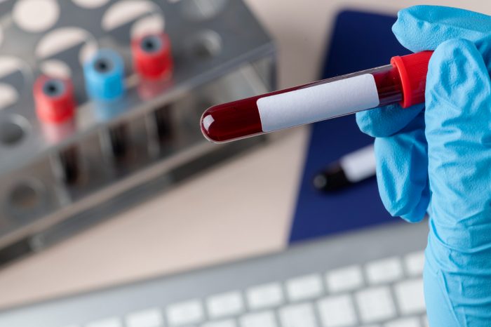 Donar sangre salva vidas. Tener la logística adecuada, también