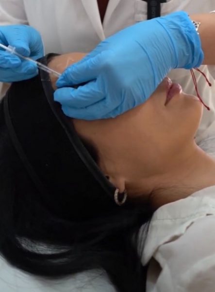 Conoce los tratamientos estéticos ideales para invierno: peeling, exosomas y láser sin riesgos