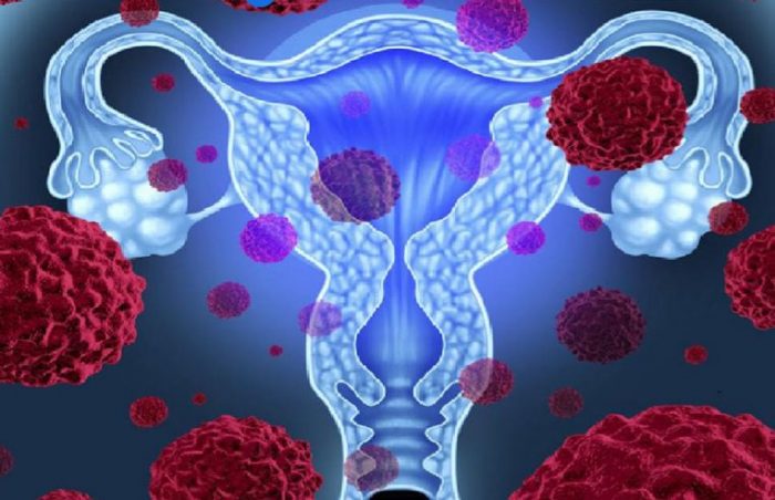 Virus del Papiloma Humano: cómo prevenirlo, detectarlo a tiempo y reducir riesgo de cáncer