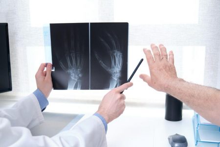 Cuando las manos hablan: cómo detectar y tratar la artrosis de manos antes de que avance