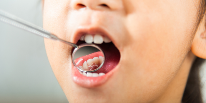 Vacaciones de invierno: una oportunidad clave para controles médicos y dentales infantiles