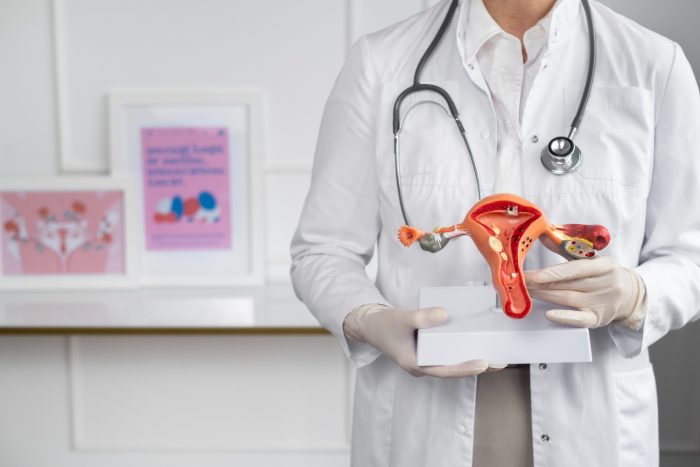 ¿Ovarios poliquísticos o síndrome de ovario poliquístico? Descubre sus diferencias y cuida tu salud