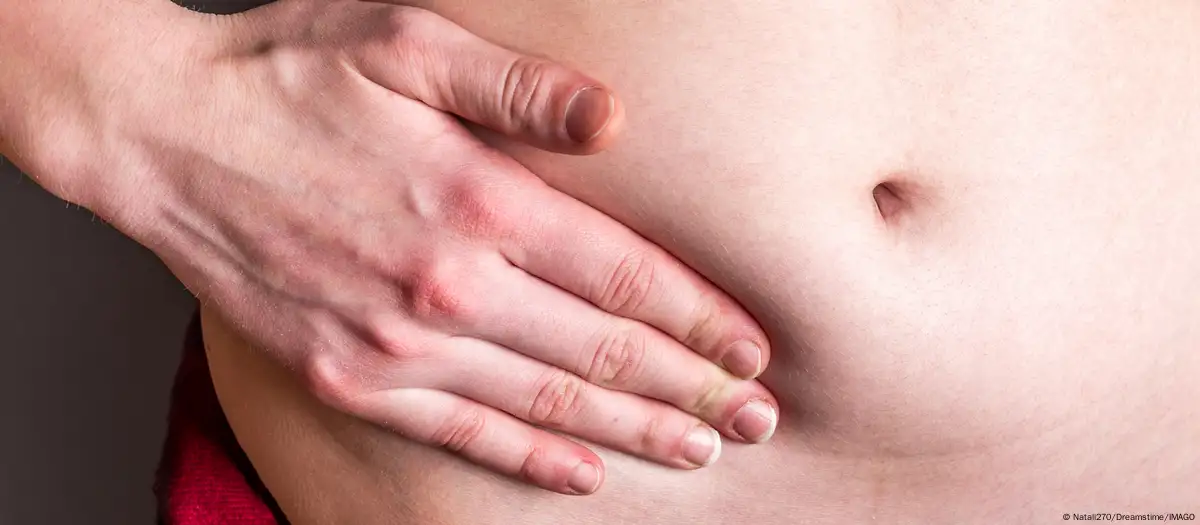 ¿Por qué el cáncer de apéndice aumenta en los jóvenes?