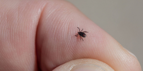 Enfermedad de Lyme: el diagnóstico que afecta a Justin Timberlake y miles de personas al año