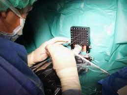 Cáncer de próstata: Fonasa e Isapres cubrirán braquiterapia con semillas radiactivas en Chile