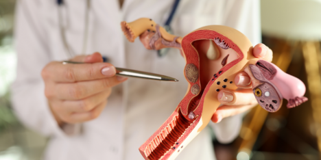 Endometriosis: una urgencia silenciosa en salud pública