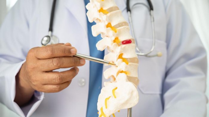 Osteoporosis: cómo detectar, prevenir y tratar esta enfermedad silenciosa que debilita los huesos
