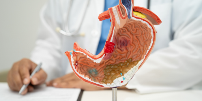 Día Mundial del Cáncer de Estómago: factores de riesgo, síntomas y avances en terapias