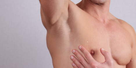 Ginecomastia: la cirugía ambulatoria que combina salud y bienestar de la confianza masculina