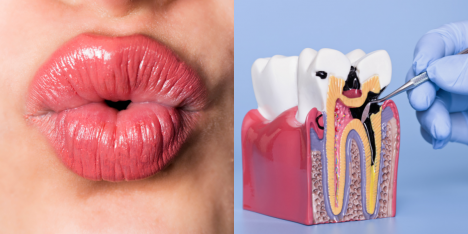 Besos y bacterias: la verdad detrás del mito de las caries contagiosas