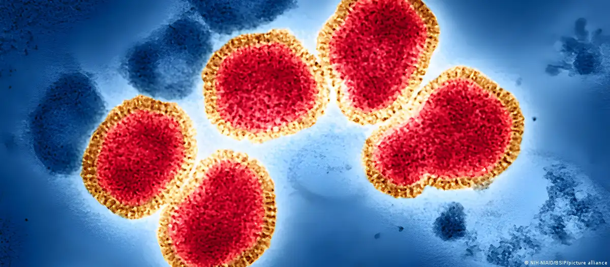 "Supergripe": confirman primer caso en Chile de nueva variante de influenza H3N2