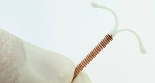DIU: mitos y verdades sobre este dispositivo, uno de los métodos anticonceptivos más eficaces
