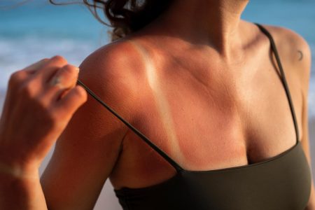 Daño solar en verano: problemas de la piel y cómo prevenir manchas y fotoenvejecimiento