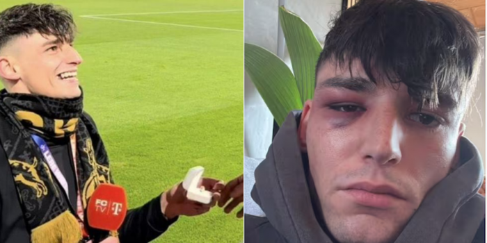 De la ovación al odio: árbitro que emocionó en la Bundesliga hoy sufre brutales ataques homofóbicos