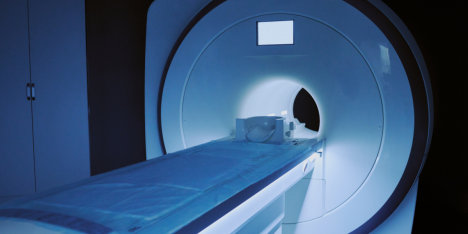 Diferencias cerebrales entre hombres y mujeres: cómo influyen tras la pubertad en la salud mental