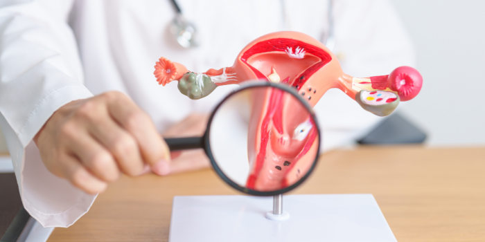 Prevenir sí es posible: el desafío frente al cáncer cervicouterino