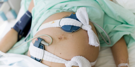 Cuando el parto no espera