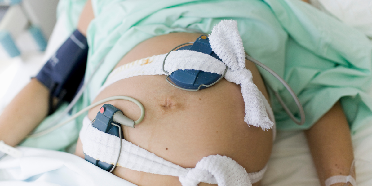 Cuando el parto no espera