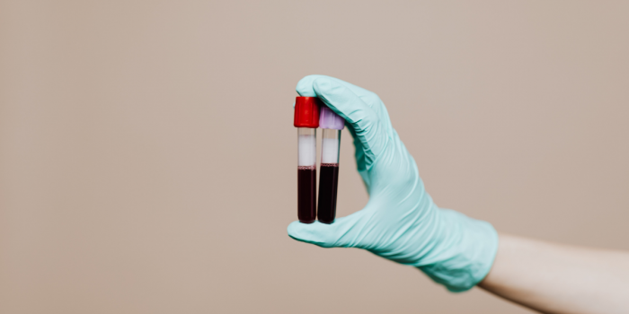 “No dejes en visto las ITS”: campaña en el Metro busca impulsar testeo y romper el estigma