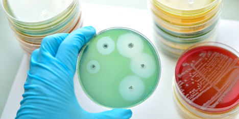 Residuos de antibióticos en aguas tratadas elevan riesgo de bacterias resistentes en Chile