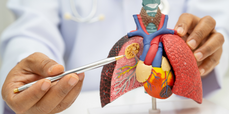 Hallazgo revela el origen único de agresivo cáncer pulmonar y abre nuevas vías de tratamiento